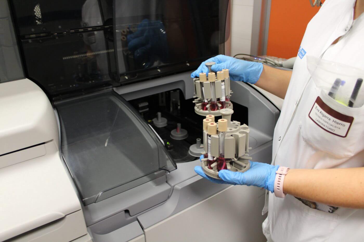 Lee más sobre el artículo El hospital San Pedro utilizará desde mañana test de antígeno CLIA para la detección del coronavirus