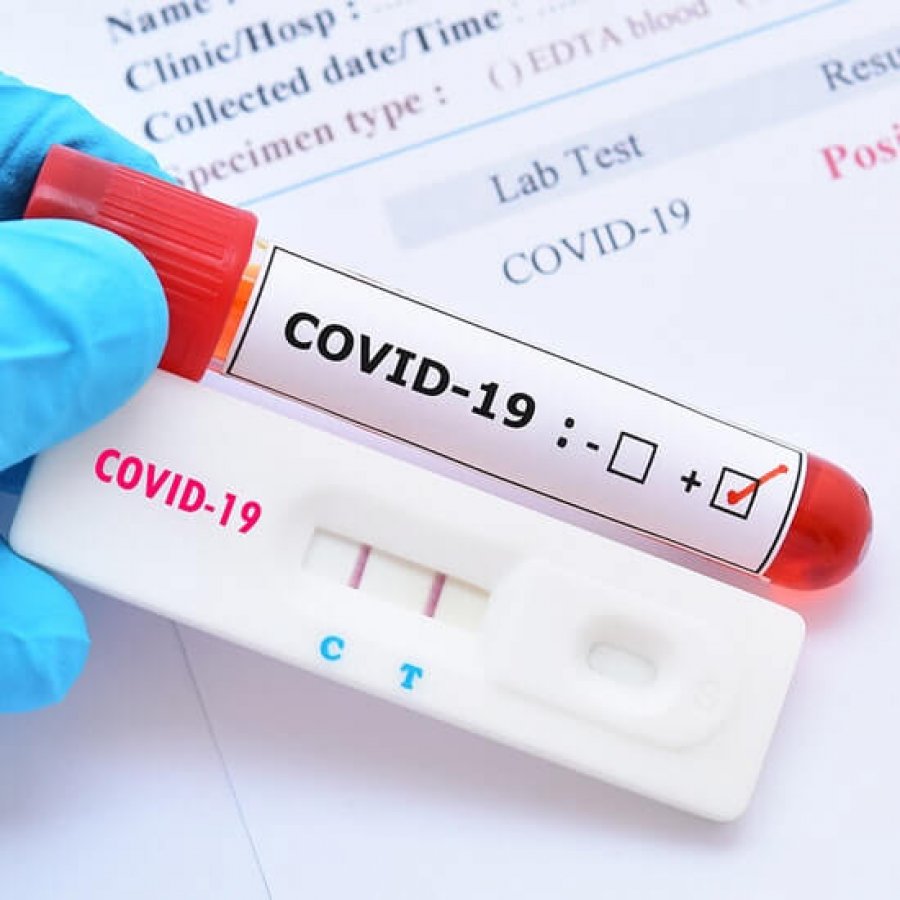 TEST COVID 1